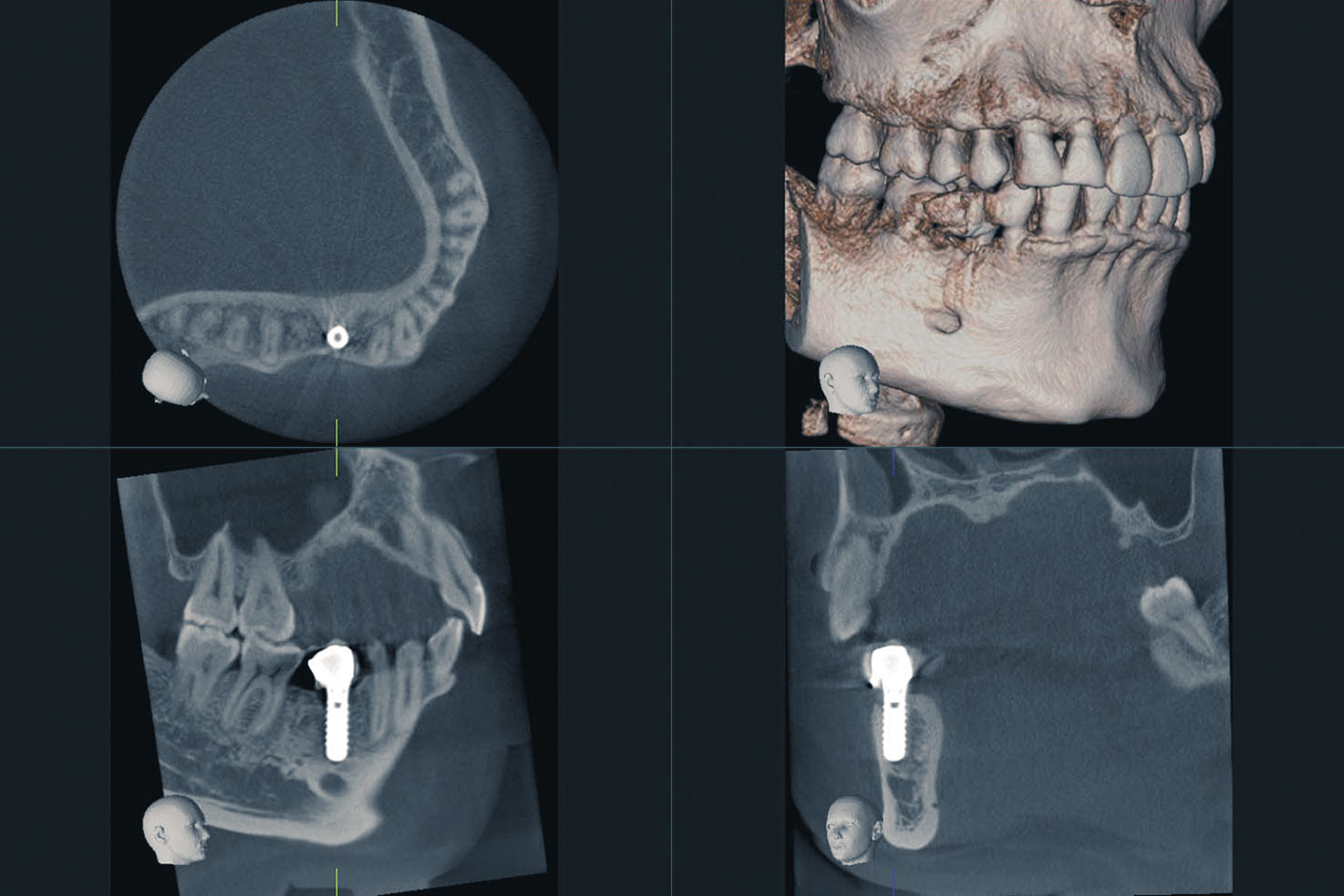 レントゲン・口腔内写真・歯茎の検査